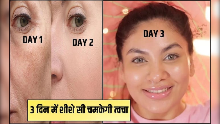 अब पार्लर का खर्चा जीरो! 3 दिन में शीशे सी चमकेगी त्वचा, 5 मिनट में तैयार करें ग्लो करने का रामबाण इलाज अब पार्लर का खर्चा जीरो! 3 दिन में शीशे सी चमकेगी त्वचा, 5 मिनट में तैयार करें ग्लो करने का रामबाण इलाज