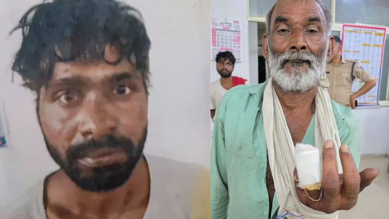 Gwalior: पैसों के विवाद में हैवान बन गया मजदूर, एक ने दूसरे की चबा डाली उंगली, इलाके में मचा हड़कंप
