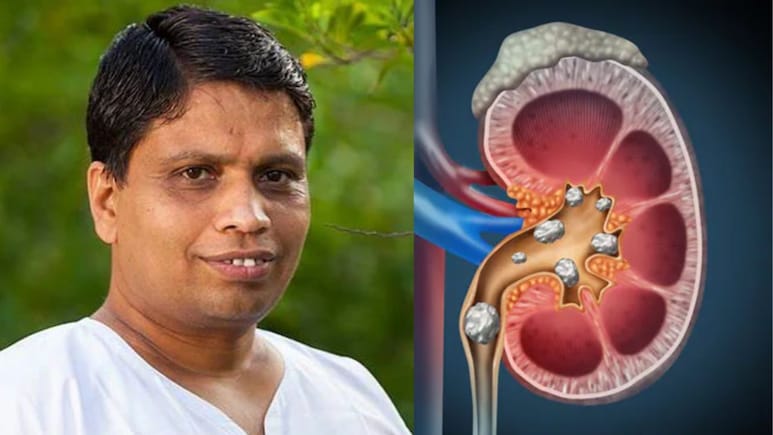 इस एक चीज को खाने से कभी नहीं होगी पथरी, Acharya Balkrishna ने बताया Kidney Stone का असरदार तोड़ इस एक चीज को खाने से कभी नहीं होगी पथरी, Acharya Balkrishna ने बताया Kidney Stone का असरदार तोड़