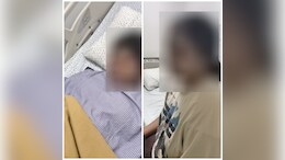 Stray Dogs Bite 2 College Students In Bengaluru