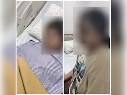 Stray Dogs Bite 2 College Students In Bengaluru Stray Dogs Bite 2 College Students In Bengaluru