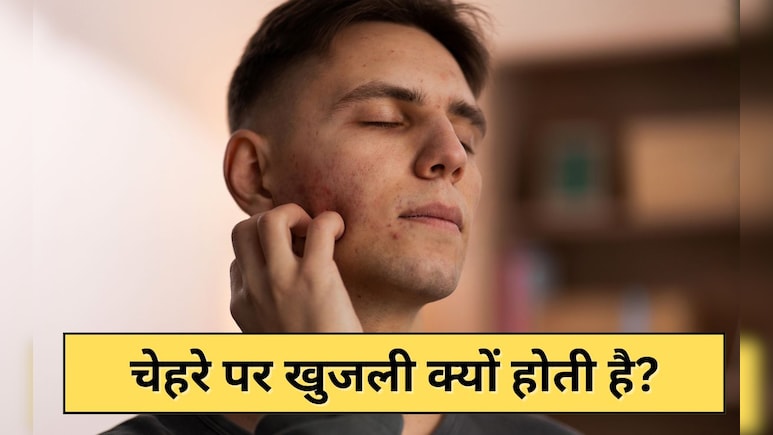 चेहरे पर खुजली क्यों होती है? एक्सपर्ट ने बताई वजह और इस दिक्कत को ठीक करन का तरीका