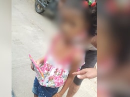 Stray Dogs Attack Nagpur Girl While She Was Playing, Bite Her Hands, Legs