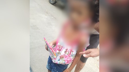 Stray Dogs Attack Nagpur Girl While She Was Playing, Bite Her Hands, Legs