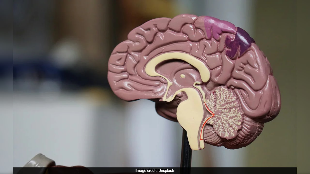 In A First, IIT Madras To Maps 100 Human Brains, From Foetus To Old Age