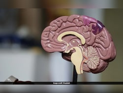 In A First, IIT Madras To Maps 100 Human Brains, From Foetus To Old Age