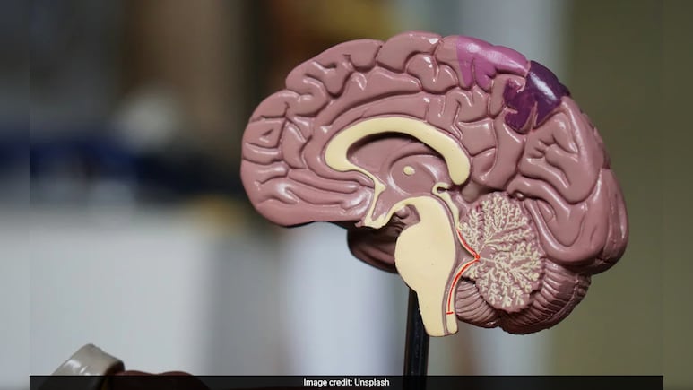 In A First, IIT Madras To Maps 100 Human Brains, From Foetus To Old Age