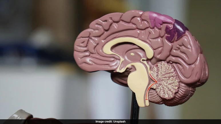 Doctor Reveals 5 Simple Hacks To Boost Brain Health, Make It Sharper Doctor Reveals 5 Simple Hacks To Boost Brain Health, Make It Sharper