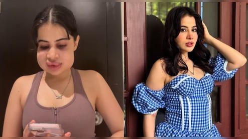 उर्फी जावेद फ‍िलर्स हटवाने के बाद नॉर्मल हुआ चेहरा, देख‍िए क‍ितनी प्‍यारी लग रही हैं अब