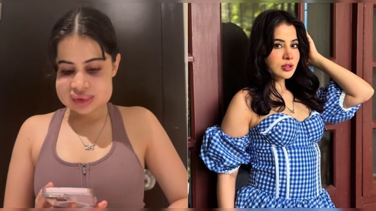 उर्फी जावेद फिलर्स हटवाने के बाद नॉर्मल हुआ चेहरा, देखिए कितनी प्यारी लग रही हैं अब उर्फी जावेद फिलर्स हटवाने के बाद नॉर्मल हुआ चेहरा, देखिए कितनी प्यारी लग रही हैं अब