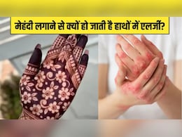 हाथों में मेहंदी लगाने से हो जाती है एलर्जी? डर्मेटोलॉजिस्ट ने बताया कैसे चुनें सही Mehndi हाथों में मेहंदी लगाने से हो जाती है एलर्जी? डर्मेटोलॉजिस्ट ने बताया कैसे चुनें सही Mehndi