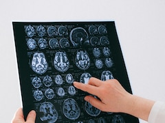 Dementia: Early Signs Beyond Cognitive Decline And Forgetfulness