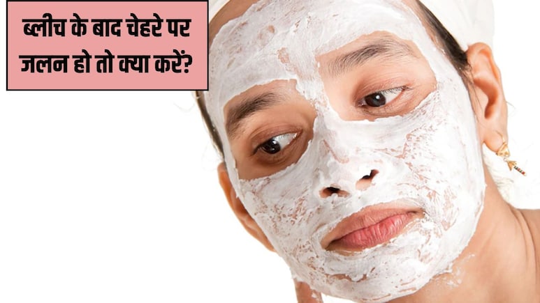 ब्लीच के बाद चेहरे पर होती है जलन? Jawed Habib ने शेयर किए 2 आसान नुस्खे, तुरंत मिल जाएगी राहत ब्लीच के बाद चेहरे पर होती है जलन? Jawed Habib ने शेयर किए 2 आसान नुस्खे, तुरंत मिल जाएगी राहत