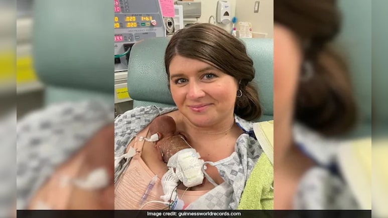 Most premature Baby: जन्म घेताच या बाळाची झाली गिनीज बुकात नोंद! काय आहे अजब रेकॉर्ड? वाचून थक्क व्हाल Most premature Baby: जन्म घेताच या बाळाची झाली गिनीज बुकात नोंद! काय आहे अजब रेकॉर्ड? वाचून थक्क व्हाल