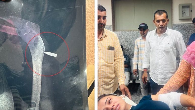 सीएम के दौरे से पहले जोधपुर में फायरिंग, SI अभ्यर्थी लड़की को लगी गोली; गहलोत ने कमिश्नर से की बात सीएम के दौरे से पहले जोधपुर में फायरिंग, SI अभ्यर्थी लड़की को लगी गोली; गहलोत ने कमिश्नर से की बात
