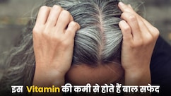 किस विटामिन की कमी से बाल सफेद होते हैं?