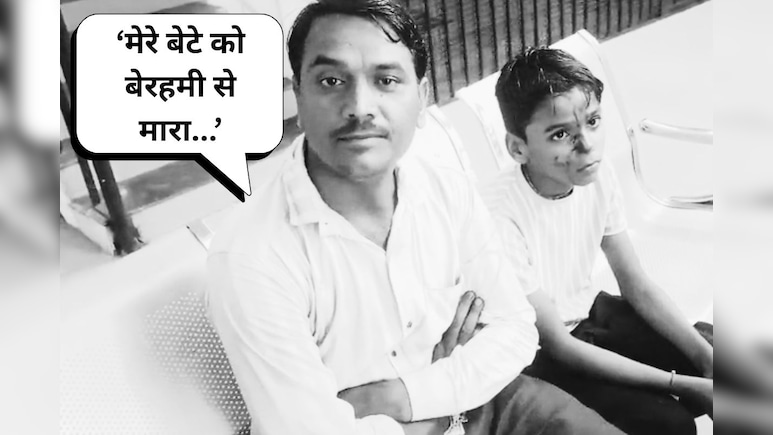 MP News: शिक्षक की पिटाई से लहूलुहान हुआ मासूम छात्र, लगे ये गंभीर आरोप