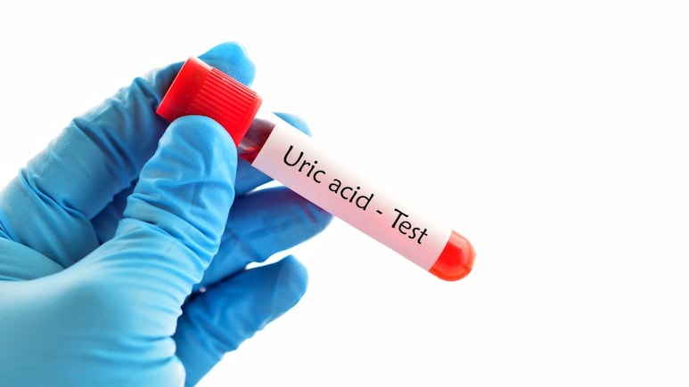 यूरिक एसिड बढ़ना ही नहीं, डाउन होना भी खतरे का संकेत, जानिए Low Uric Acid के साइड इफेक्ट्स