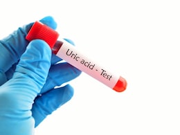 यूरिक एसिड बढ़ना ही नहीं, डाउन होना भी खतरे का संकेत, जानिए Low Uric Acid के साइड इफेक्ट्स यूरिक एसिड बढ़ना ही नहीं, डाउन होना भी खतरे का संकेत, जानिए Low Uric Acid के साइड इफेक्ट्स