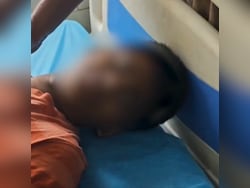 2 Students Burn Boy&#039;s Stomach, Hands With Iron Box In Andhra Pradesh: Cops