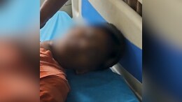 2 Students Burn Boy's Stomach, Hands With Iron Box In Andhra Pradesh: Cops