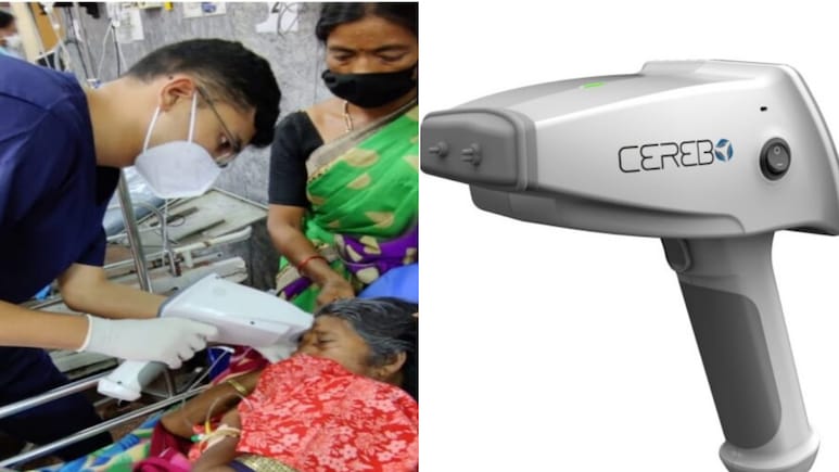 MRI-CT की अब जरुरत नहीं, अब मिनटों में बिना चीरा लगाए चलेगा दिमाग की चोट का पता