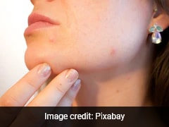Woman Lands In Hospital After Popping Pimple, Warns of 