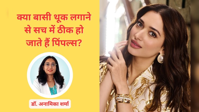 क्या बासी थूक लगाने से सच में ठीक हो जाते हैं पिंपल्स? जानें कितना असरदार है तमन्ना भाटिया का ब्यूटी हैक क्या बासी थूक लगाने से सच में ठीक हो जाते हैं पिंपल्स? जानें कितना असरदार है तमन्ना भाटिया का ब्यूटी हैक