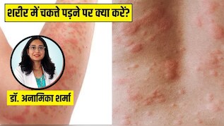 शरीर पर क्यों पड़ जाते हैं लाल रंग के चकत्ते? स्किन की डॉक्टर से जानें ऐसा होने पर सबसे पहले क्या करें, कैसे मिलेगी तुरंत राहत