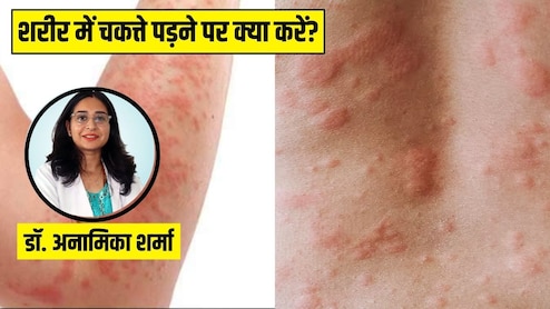 शरीर पर क्यों पड़ जाते हैं लाल रंग के चकत्ते? स्किन की डॉक्टर से जानें ऐसा होने पर सबसे पहले क्या करें