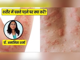 शरीर पर क्यों पड़ जाते हैं लाल रंग के चकत्ते? स्किन की डॉक्टर से जानें ऐसा होने पर सबसे पहले क्या करें शरीर पर क्यों पड़ जाते हैं लाल रंग के चकत्ते? स्किन की डॉक्टर से जानें ऐसा होने पर सबसे पहले क्या करें