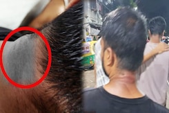 Calcutta University Students Beaten Up For Speaking Bengali, Called 'Bangladeshis' Calcutta University Students Beaten Up For Speaking Bengali, Called 'Bangladeshis'