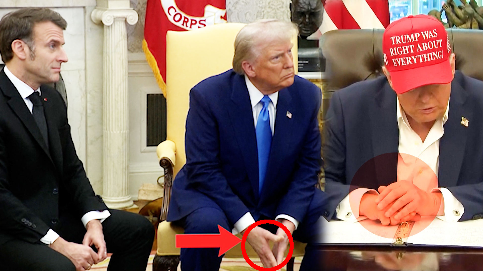 Tucked Hand, Visible Makeup: Donald Trump's Appearance Fuels Health Talk Again