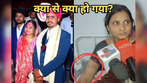 Crime News: पति ने की हैवानियत की सारी हदें पार, पहले चाकू गर्म करके पत्नी को दागा, फिर की पिटाई
