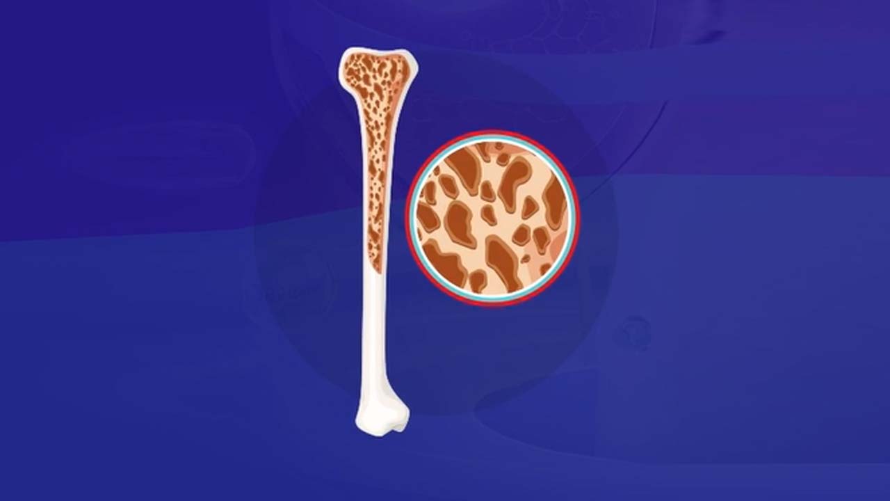 Lifelong Bone Health: Improving Bone Density Is Achievable At Any Stage