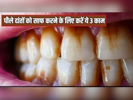 Coffee और सिगरेट पीकर पीले पड़ चुके हैं दांत? डॉक्टर ने बताया इन 3 तरीकों से सफेद हो जाएंगे Yellow Teeth, दूर से नजर आएगी स्माइल Coffee और सिगरेट पीकर पीले पड़ चुके हैं दांत? डॉक्टर ने बताया इन 3 तरीकों से सफेद हो जाएंगे Yellow Teeth, दूर से नजर आएगी स्माइल