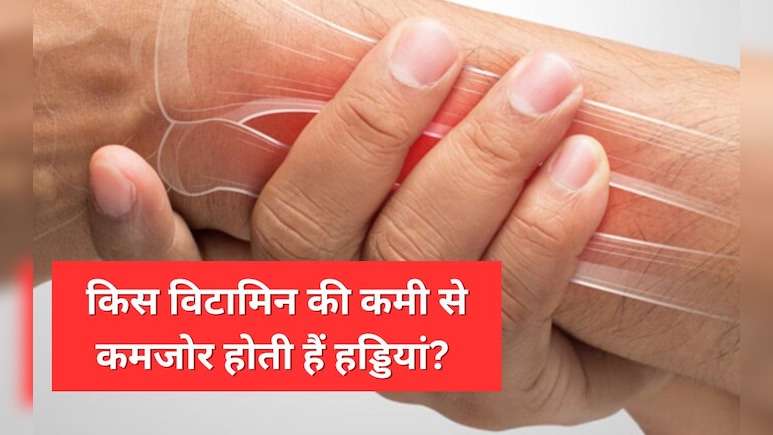 किस विटामिन की कमी से हड्डियां हो जाती हैं कमजोर, जान लीजिए यहां