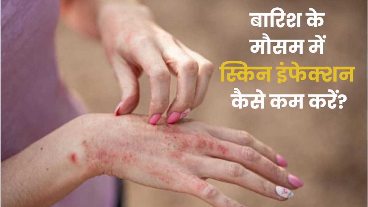 बरसात में स्किन इंफेक्शन से हैं परेशान? न करें ये गलतियां