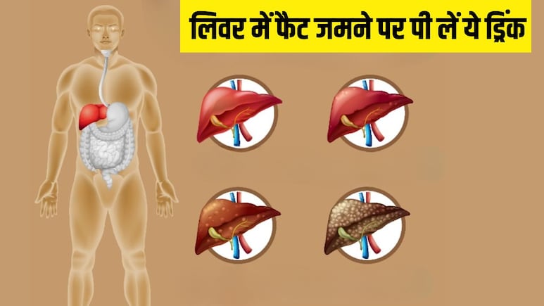 खाली पेट पानी में उबालकर पी लें ये चीजें, आयुर्वेदिक डॉ. ने बताया 14 दिनों में पिघलने लगेगा लिवर पर जमा फैट खाली पेट पानी में उबालकर पी लें ये चीजें, आयुर्वेदिक डॉ. ने बताया 14 दिनों में पिघलने लगेगा लिवर पर जमा फैट