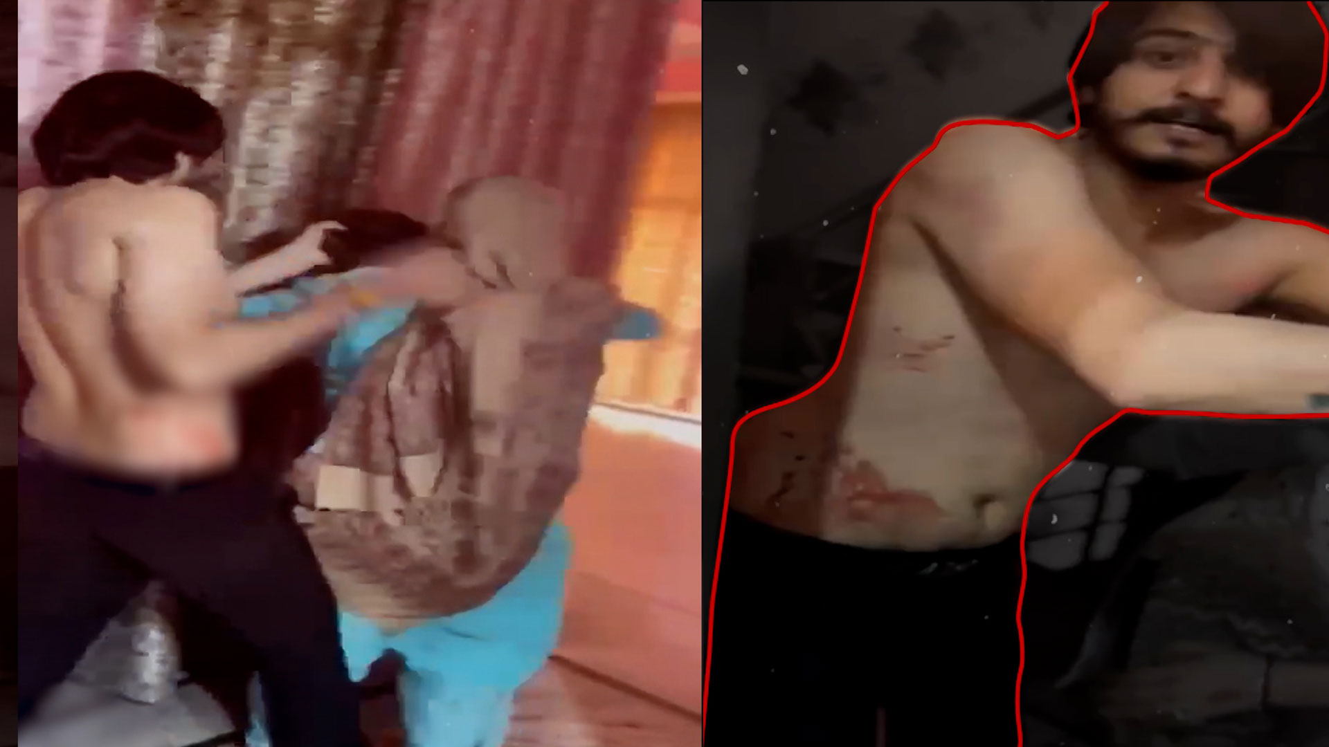 Dowry Murder Accused Shot, Hours After Woman's Father Demanded 'Encounter'