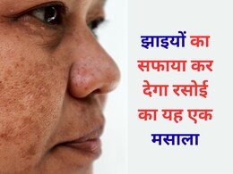 झाइयों से दागदाग नजर आता है चेहरा तो एक्सपर्ट का बताया फेस पैक दिखा सकता है असर, बेदाग नजर आएगी त्वचा झाइयों से दागदाग नजर आता है चेहरा तो एक्सपर्ट का बताया फेस पैक दिखा सकता है असर, बेदाग नजर आएगी त्वचा