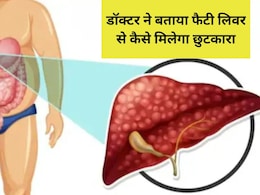लिवर के डॉक्टर ने बताए फैटी लिवर के सारे सीक्रेट्स, जान लें मास्टर प्लेयर ऑर्गन को पावरफुल बनाने के अचूक उपाय लिवर के डॉक्टर ने बताए फैटी लिवर के सारे सीक्रेट्स, जान लें मास्टर प्लेयर ऑर्गन को पावरफुल बनाने के अचूक उपाय