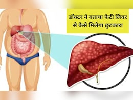 बिना दवाइयों के इस तरह होगी फैटी लिवर की दिक्कत दूर, Dr. Sethi ने बताया घरेलू इलाज