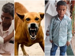Rajasthan Dog Attack: अलवर में कुत्तों के झुंड ने 8 साल के मासूम को नोचा, 50 से ज्यादा घाव, पूरा शरीर पट्टियों में लिपटा Rajasthan Dog Attack: अलवर में कुत्तों के झुंड ने 8 साल के मासूम को नोचा, 50 से ज्यादा घाव, पूरा शरीर पट्टियों में लिपटा