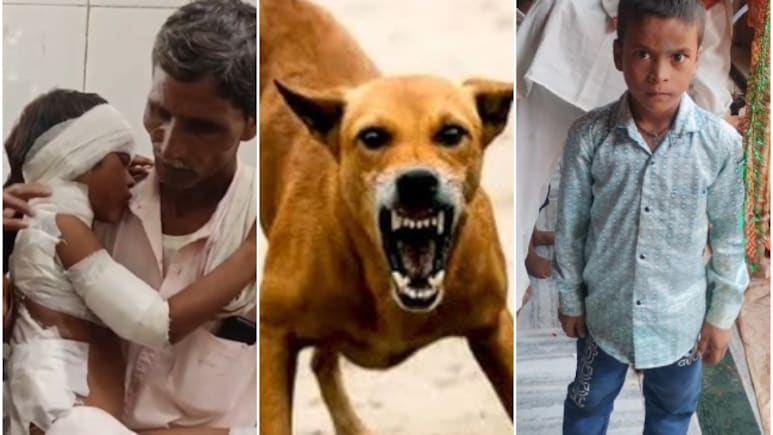Rajasthan Dog Attack: अलवर में कुत्तों के झुंड ने 8 साल के मासूम को नोचा, 50 से ज्यादा घाव, पूरा शरीर पट्टियों में लिपटा Rajasthan Dog Attack: अलवर में कुत्तों के झुंड ने 8 साल के मासूम को नोचा, 50 से ज्यादा घाव, पूरा शरीर पट्टियों में लिपटा