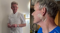 Gordon Ramsay Reveals Skin Cancer Surgery, Urges Fans To Wear Sunscreen