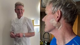 Chef Gordon Ramsay Reveals Skin Cancer Surgery, Urges Fans To Wear Sunscreen