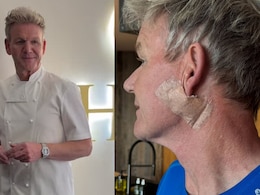 Chef Gordon Ramsay Reveals Skin Cancer Surgery, Urges Fans To Wear Sunscreen Chef Gordon Ramsay Reveals Skin Cancer Surgery, Urges Fans To Wear Sunscreen