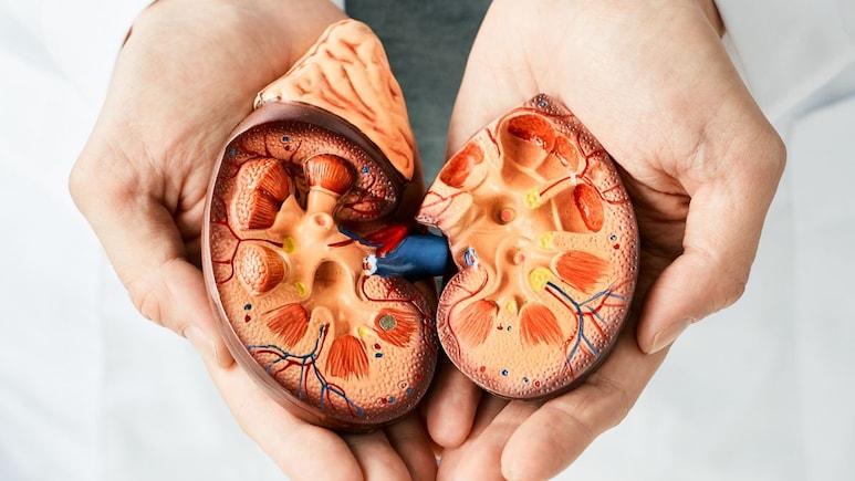 Follow These Do's And Don'ts To Prevent Kidney Stone Recurrence