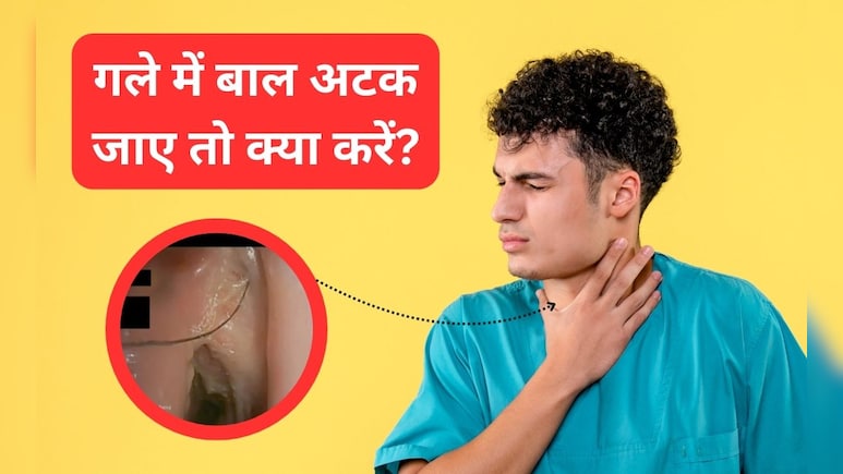 गले में बाल फंस जाए तो क्या करना चाहिए? डॉक्टर ने बताया घर पर 2 मिनट में कैसे करें गला साफ